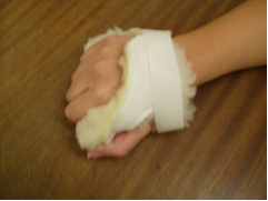 Hand splint 2